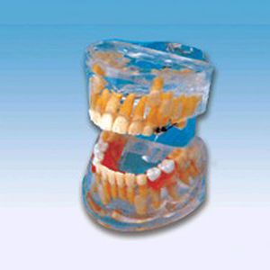 Transparent baby teeth development model